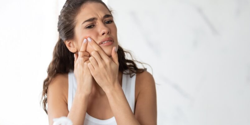 Acne & Pimples Treatments wakad