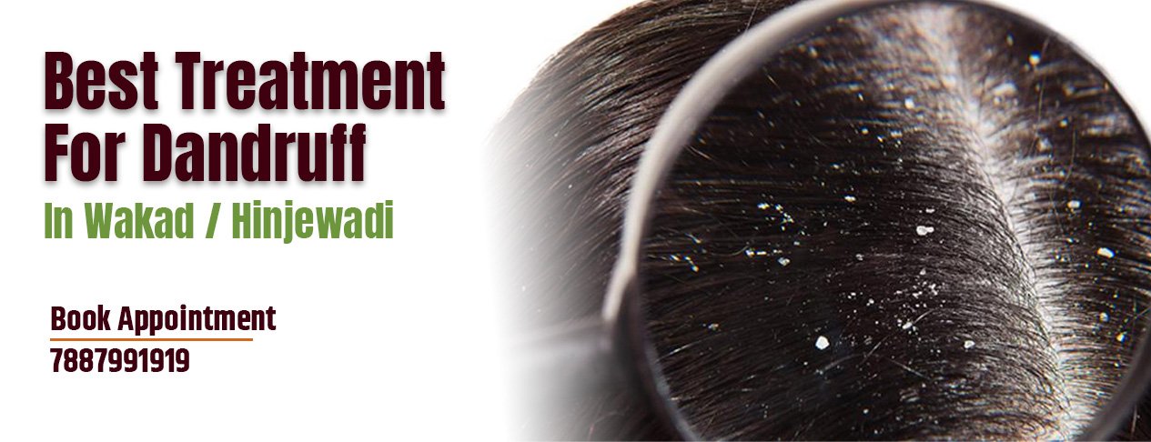 Anti Dandruff Hair Spa Mask 50 G – Organicos India Store