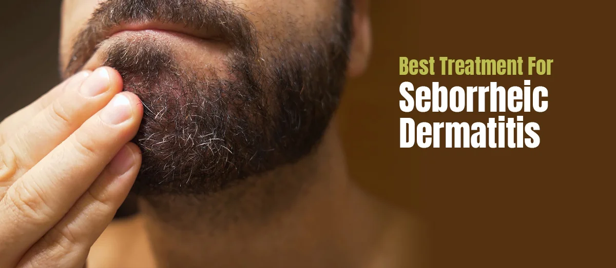 Seborrheic Dermatitis