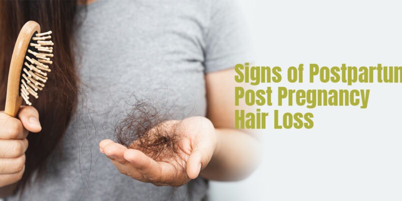 Signs of Post Pregnancy Hair Loss