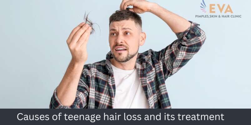 hair loss treatment in Pune