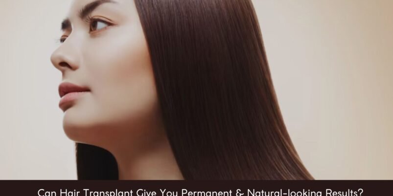 Can-Hair-Transplant-Give-You-Permanent-Natural-looking-Results