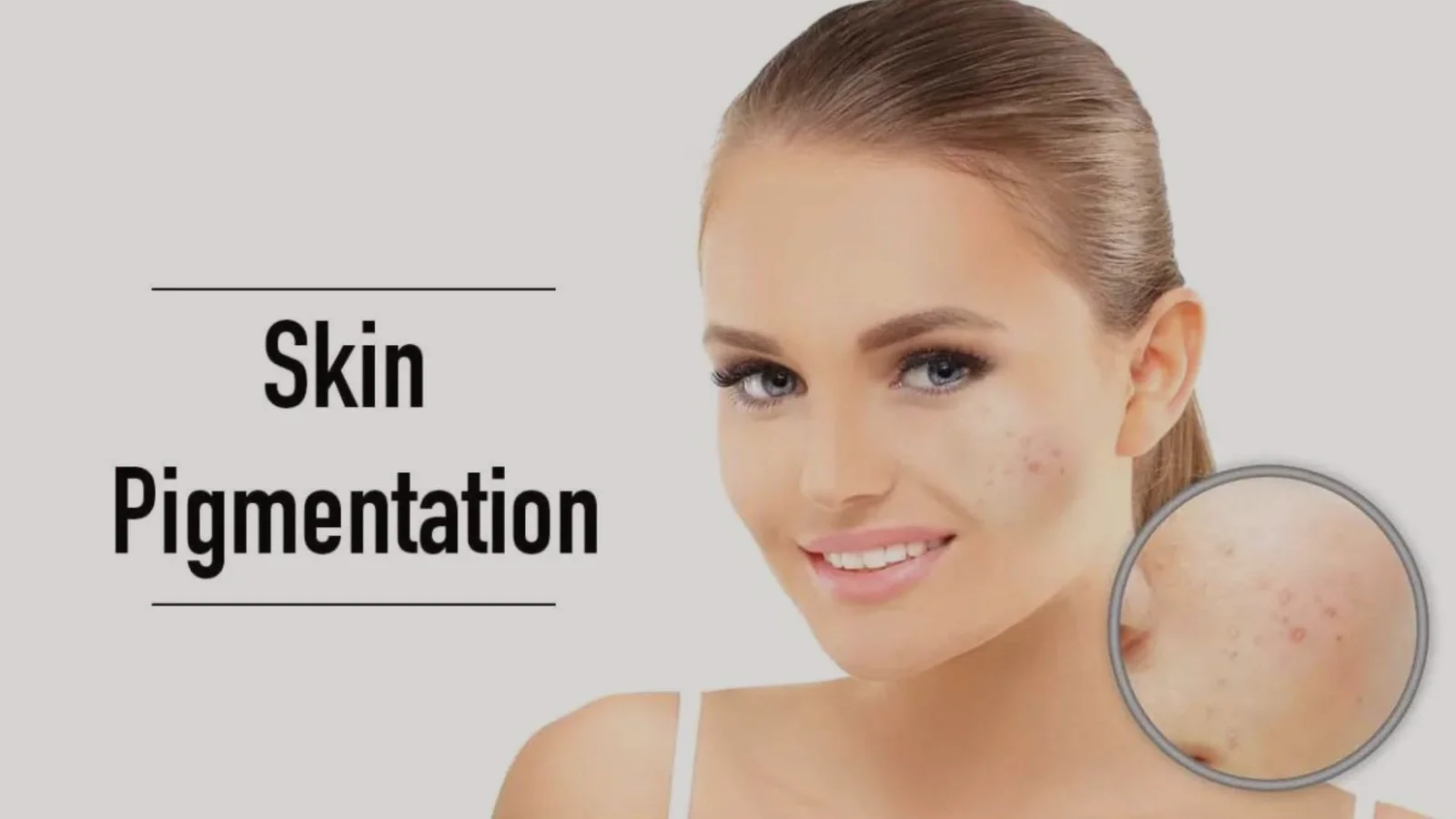 Pigmentation