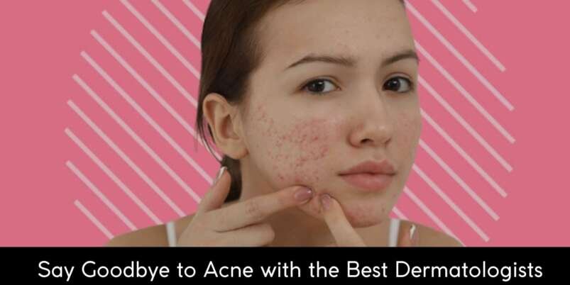 dermatologists for acne