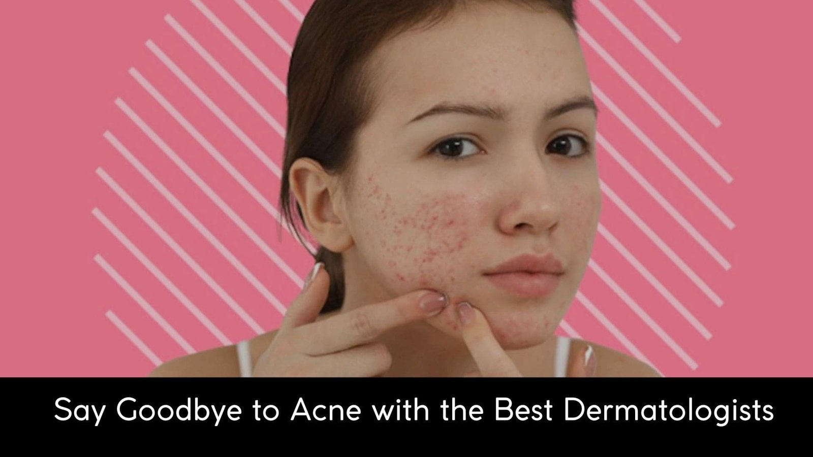 dermatologists for acne
