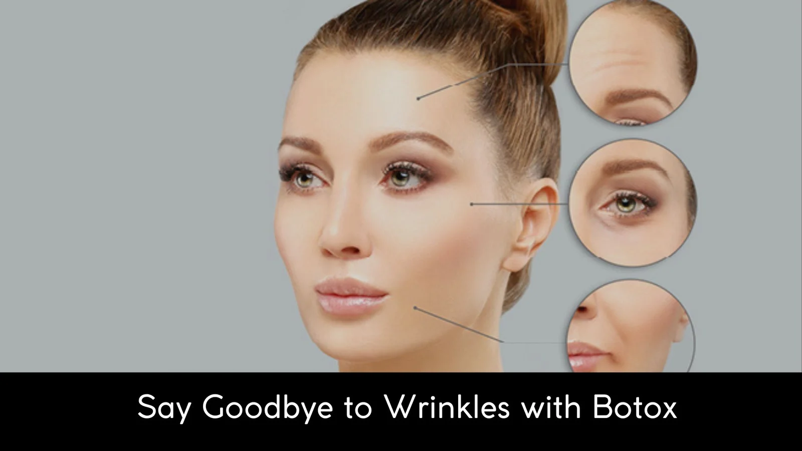 Wrinkles with Botox