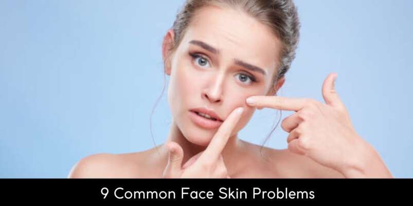 9-Common-Face-Skin-Problems