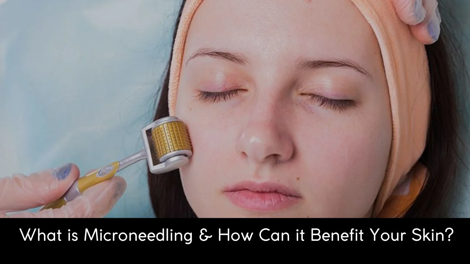Microneedling