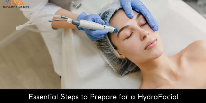 Essential-Steps-to-Prepare-for-a-HydraFacial-Banner