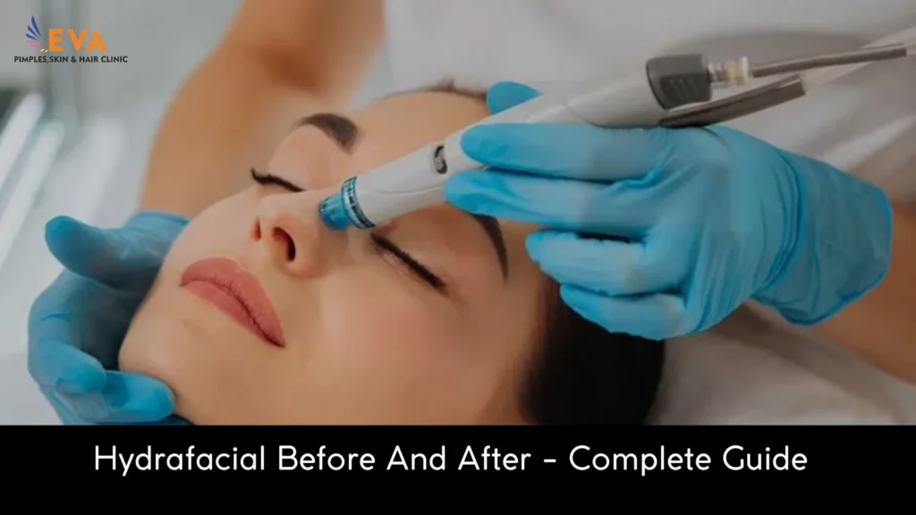 hydrafacial