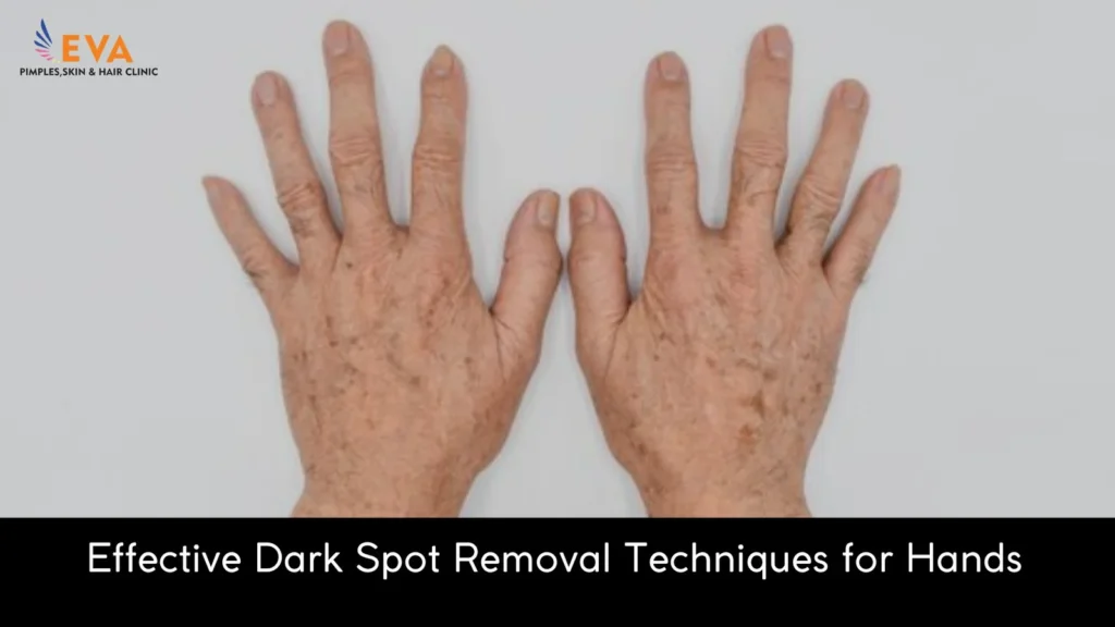 dark spots