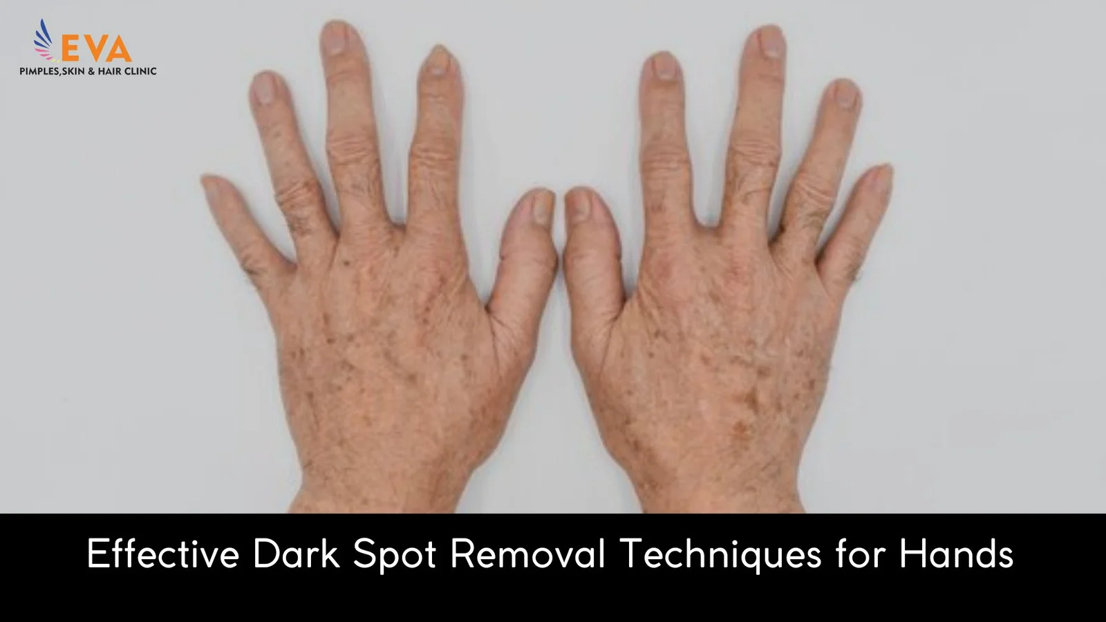 dark spots