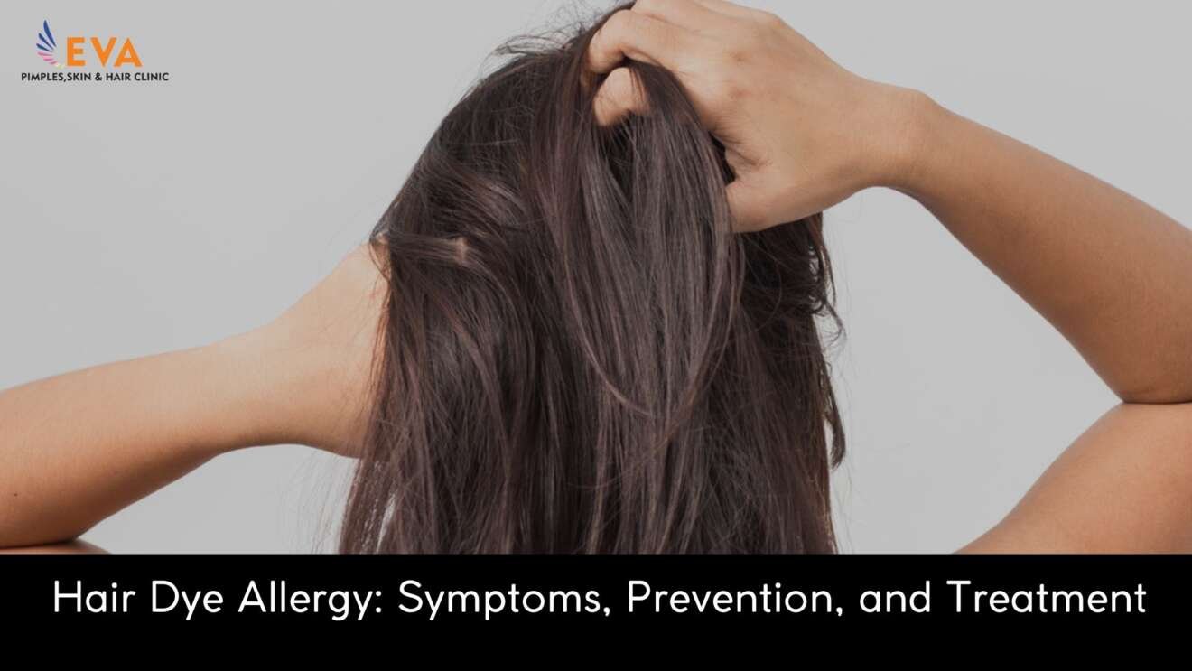 Hair Dye Allergy Symptoms, Prevention, and Treatment