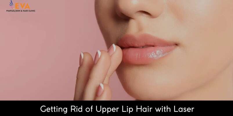 Getting-Rid-of-Upper-Lip-Hair-with-Laser-Banner