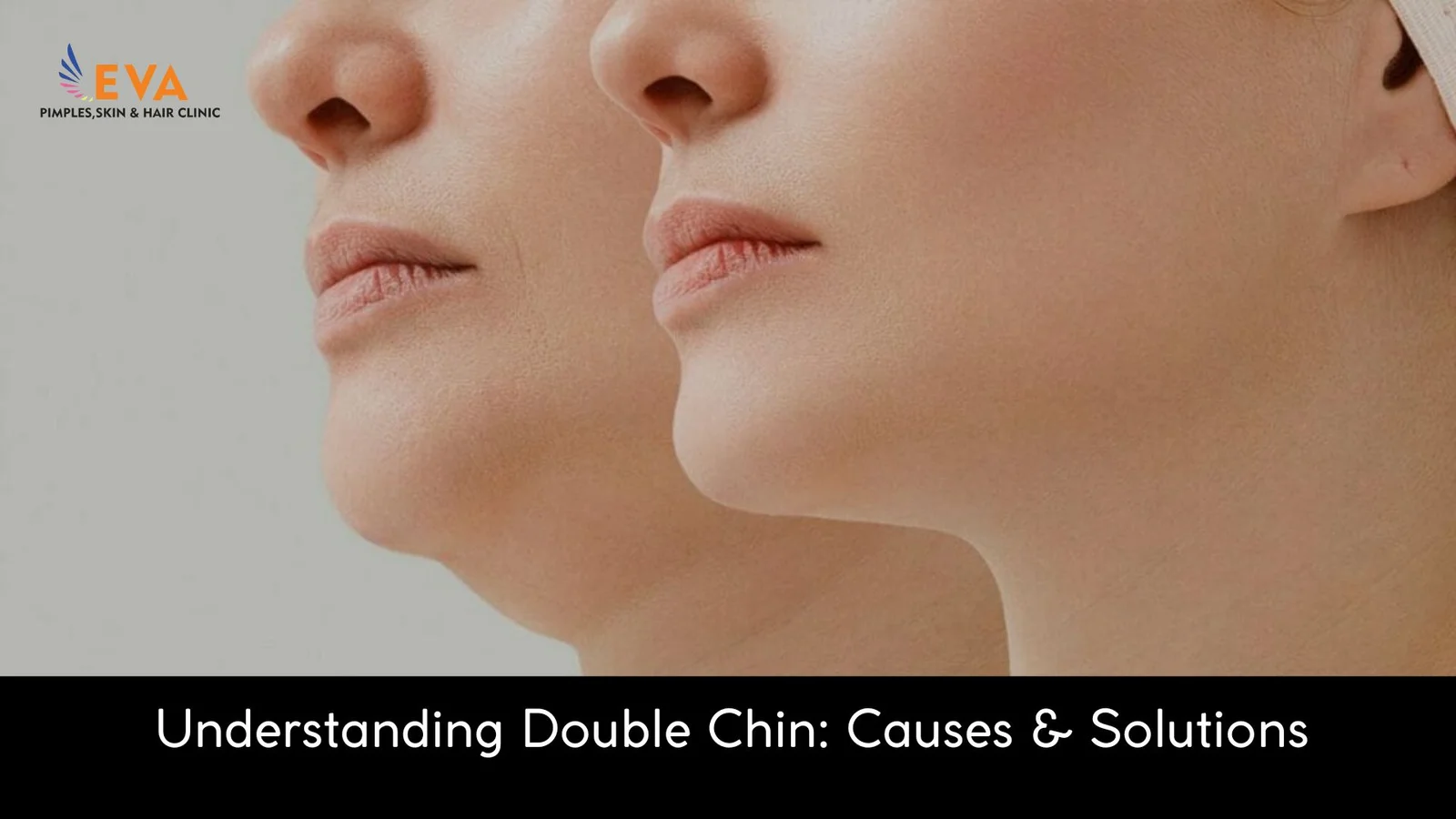 double chin