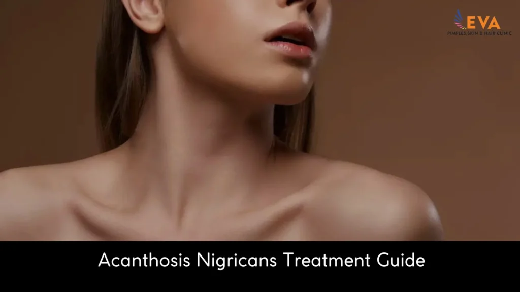 Acanthosis Nigricans