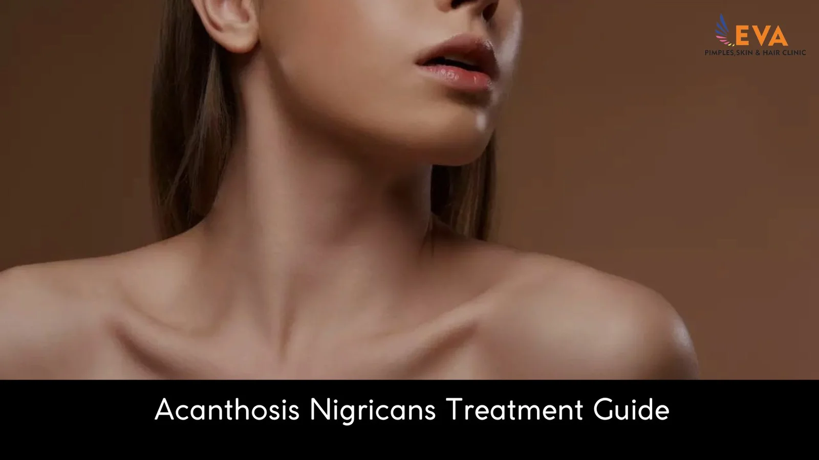 Acanthosis Nigricans