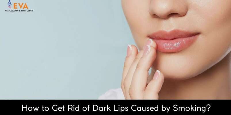 How-to-Get-Rid-of-Dark-Lips-Caused-by-Smoking-Banner