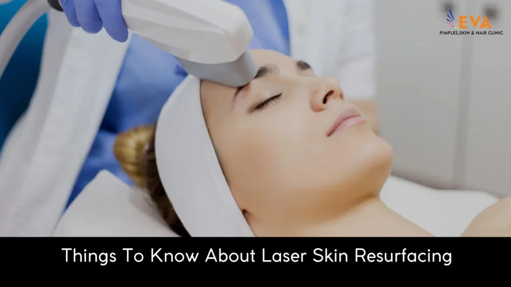 laser skin resurfacing