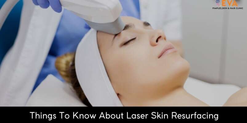 Laser Skin Resurfacing treatment