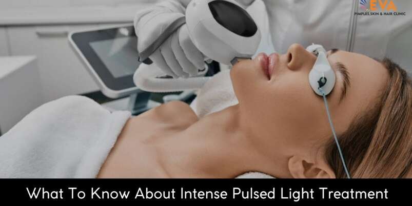 What-To-Know-About-Intense-Pulsed-Light-Treatment