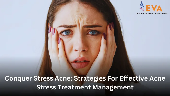 acne scar treatment in pune