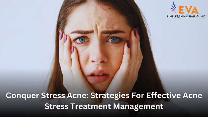 acne scar treatment in pune