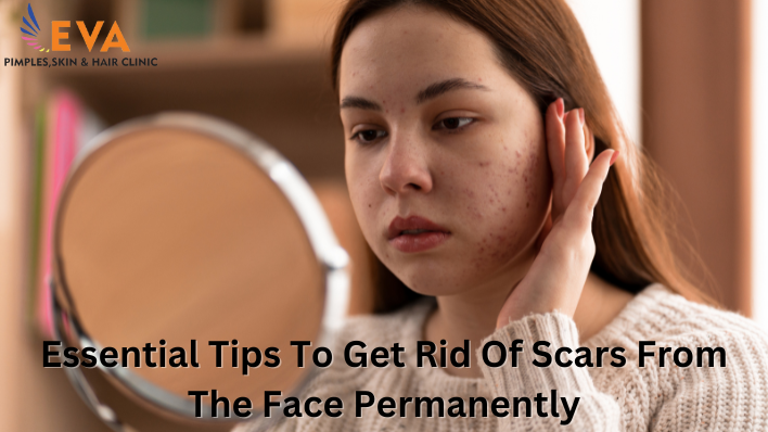 Essential Tips To Get Rid Of Scars From The Face Permanently