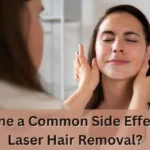 laser hair removal