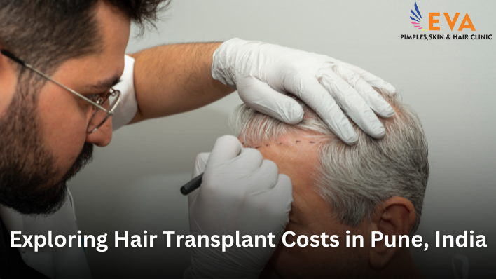 Exploring Hair Transplant Costs in Pune, India