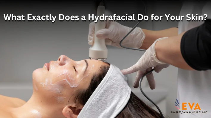 hydrafacial