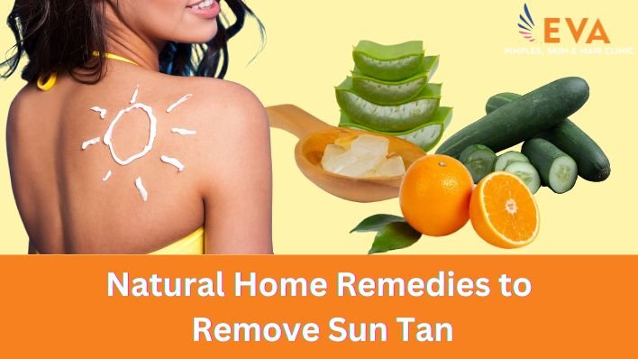 Natural Home Remedies to Remove Sun Tan