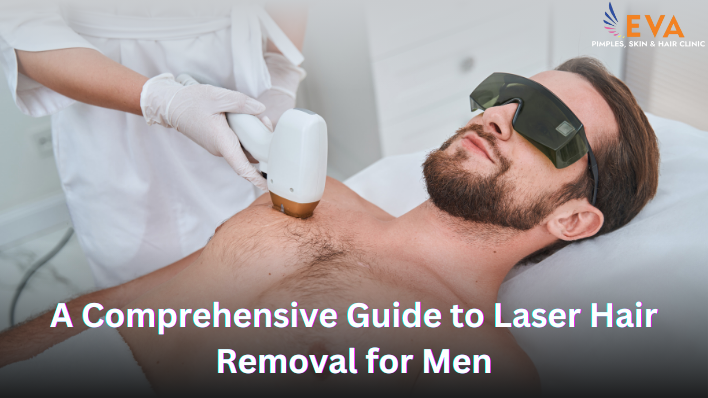 A Comprehensive Guide to Laser Hair Removal for Men