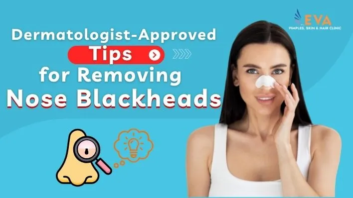 Dermatologist-Approved Tips for Removing Nose Blackheads