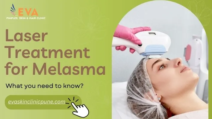 Laser Treatments for Melasma: What You Need to Know