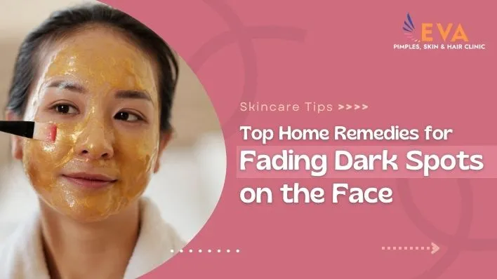 Top Home Remedies for Fading Dark Spots on the Face