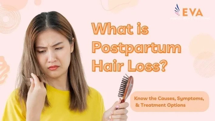 What is Postpartum Hair Loss - Causes, Symptoms, and Treatment