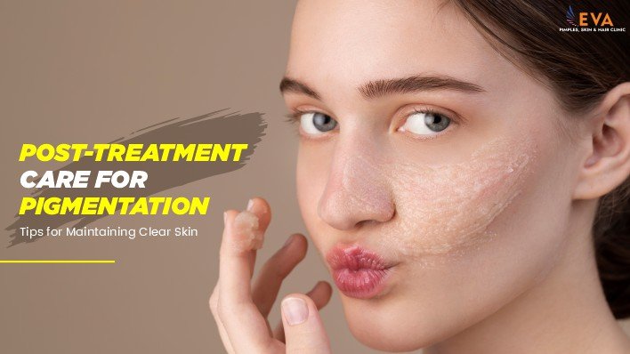 Post-Treatment Care for Pigmentation: Tips for Maintaining Clear Skin