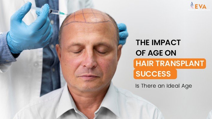 The Impact of Age on Hair Transplant Success: Is There an Ideal Age?