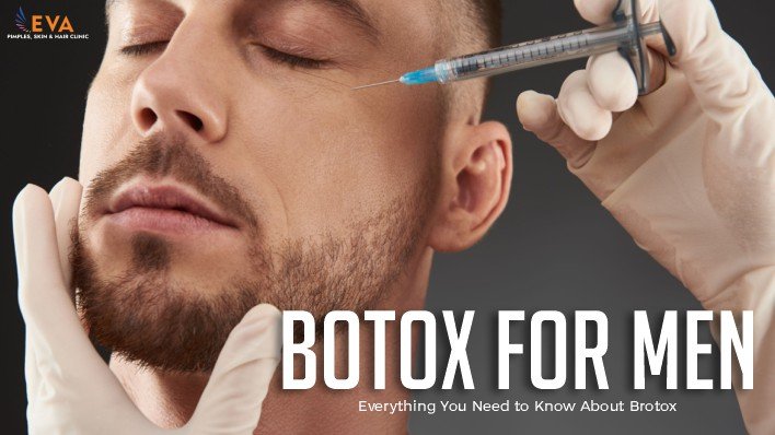 botox for men