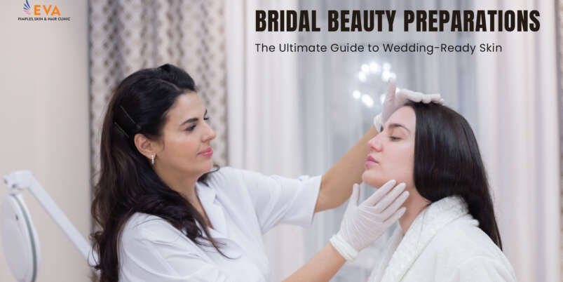 Bridal Beauty Preparations The Ultimate Guide to Wedding-Ready Skin