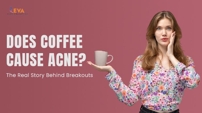 Does Coffee Cause Acne? The Real Story Behind Breakouts