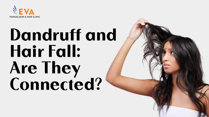 dandruff