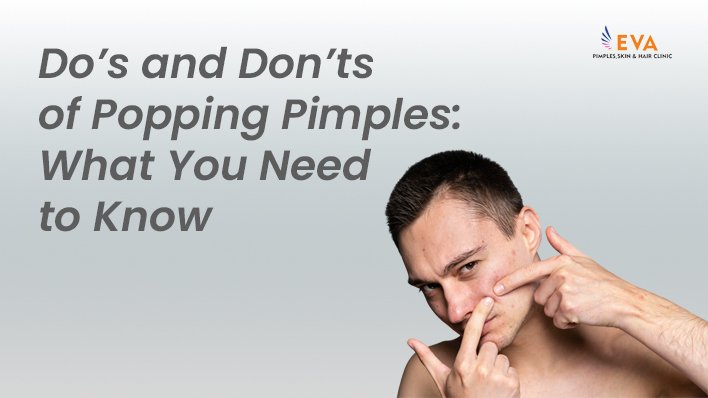 Dos and Don’ts of Popping Pimples: What You Need to Know?