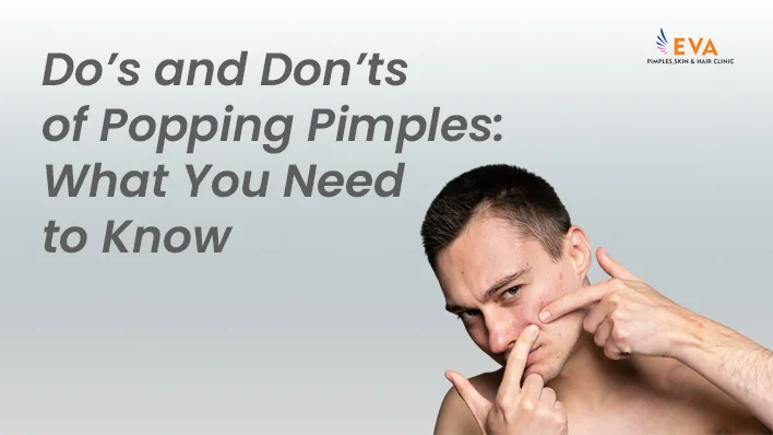 popping pimples