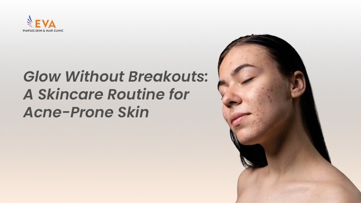 Glow Without Breakouts: A Skincare Routine for Acne-Prone Skin