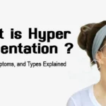 pigmentation