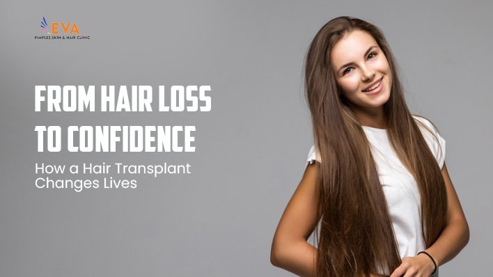 From Hair Loss to Confidence: How a Hair Transplant Changes Lives?