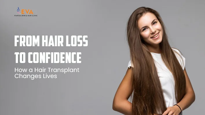 hair transplant
