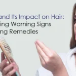 hair loss